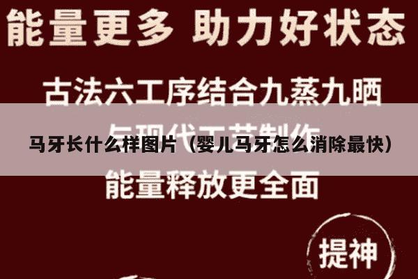 马牙长什么样图片（婴儿马牙怎么消除最快）
