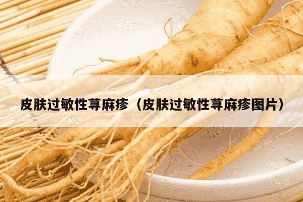 皮肤过敏性荨麻疹（皮肤过敏性荨麻疹图片）