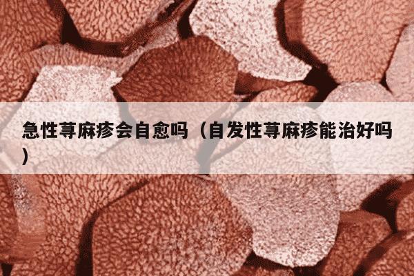 急性荨麻疹会自愈吗（自发性荨麻疹能治好吗）