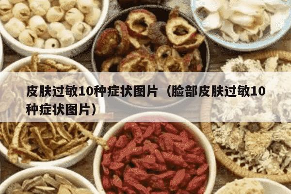 皮肤过敏10种症状图片（脸部皮肤过敏10种症状图片）