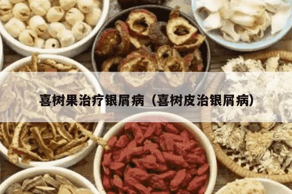 喜树果治疗银屑病（喜树皮治银屑病）