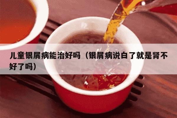 儿童银屑病能治好吗（银屑病说白了就是肾不好了吗）