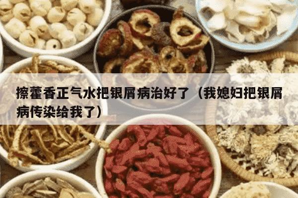 擦藿香正气水把银屑病治好了（我媳妇把银屑病传染给我了）