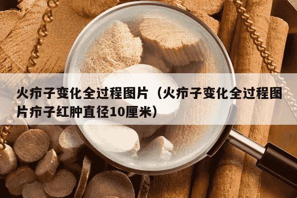 火疖子变化全过程图片（火疖子变化全过程图片疖子红肿直径10厘米）