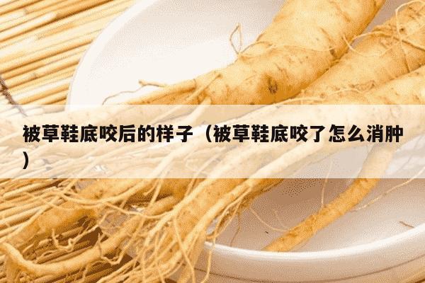 被草鞋底咬后的样子（被草鞋底咬了怎么消肿）