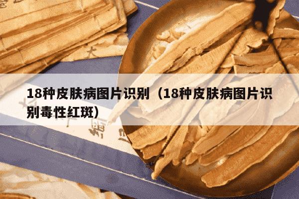 18种皮肤病图片识别（18种皮肤病图片识别毒性红斑）