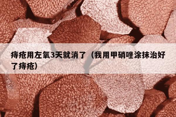 痔疮用左氧3天就消了（我用甲硝唑涂抹治好了痔疮）