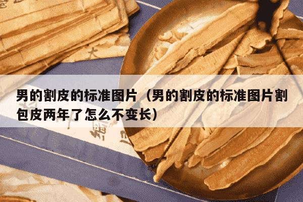 男的割皮的标准图片（男的割皮的标准图片割包皮两年了怎么不变长）