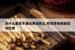 <b>Ϊʲôҽ��������������ֹ,��ѩ�����ǰ��Ա���</b>