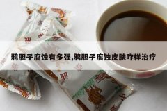 <b>ѻ���Ӹ�ʴ�ж�ǿ,ѻ���Ӹ�ʴƤ��զ������</b>