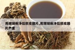 <b>��ɺ��Ѣ������ƤͼƬ,��ɺ��Ѣ������ƤͼƬ����</b>