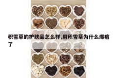 <b>��ѩ�ݵĻ���Ʒ��ô��,�û�ѩ��Ϊʲô������</b>