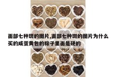 <b>�沿���ְߵ�ͼƬ,�沿���ְߵ�ͼƬΪʲô����̵��ư���������</b>