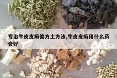 <b>ר��ţƤƤѢƫ��������,ţƤƤѢ��ʲôҩ���</b>